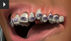 Orthodontics